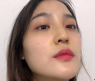 鼻子整形失败的明星